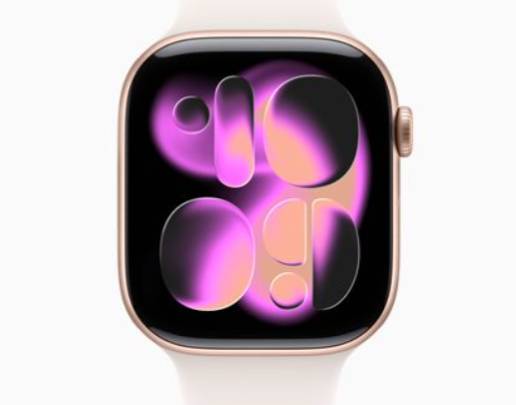 Apple Watch Series 11 46mm GPS+Cellularモデル ローズゴールドアルミニウムケース バンドなし 64GB